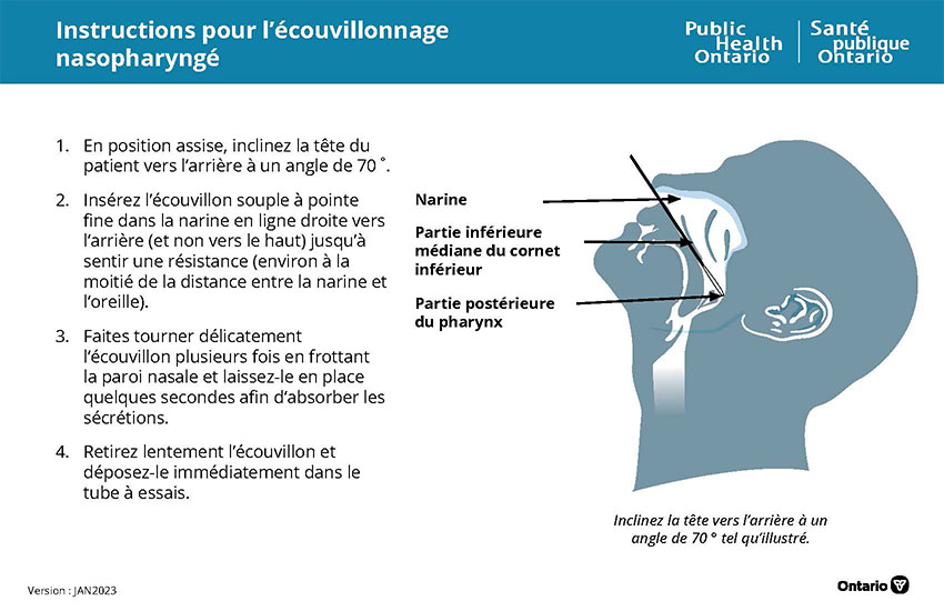 Instructions pour l’écouvillonnage nasopharyngé