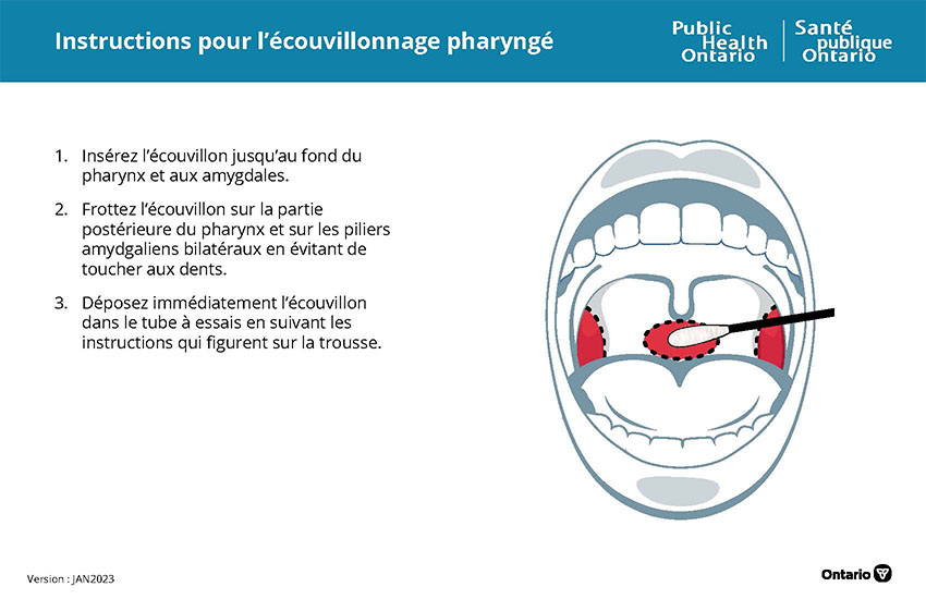 Instructions pour l’écouvillonnage pharyngé